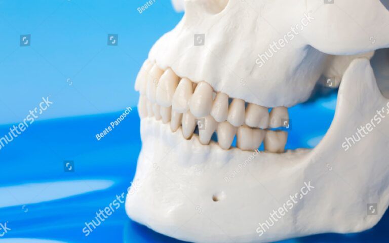 A Jawbone