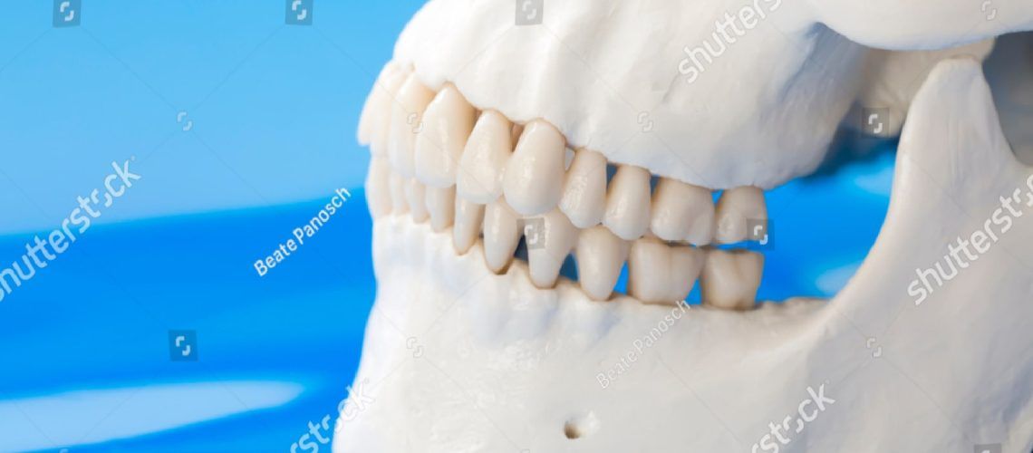 A Jawbone
